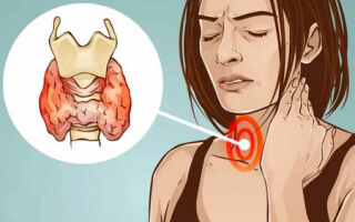 Гипоплазия щитовидной железы: причины, симптомы и методы лечения