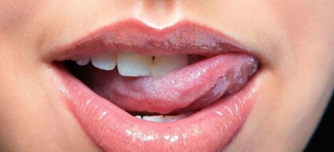 Причины развития кандидоза полости рта: симптомы и лечение