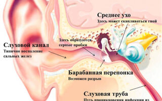 Причины боли в ушах и горле