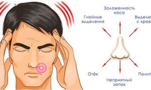 Заложенность носа без насморка: причины и способы лечения