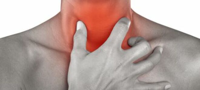 Болит горло без повышения температуры тела