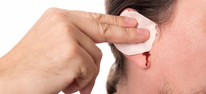 Кровь из уха: механические, инфекционные и онкологические причины