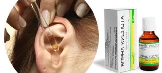 Борная кислота при лечении ушей